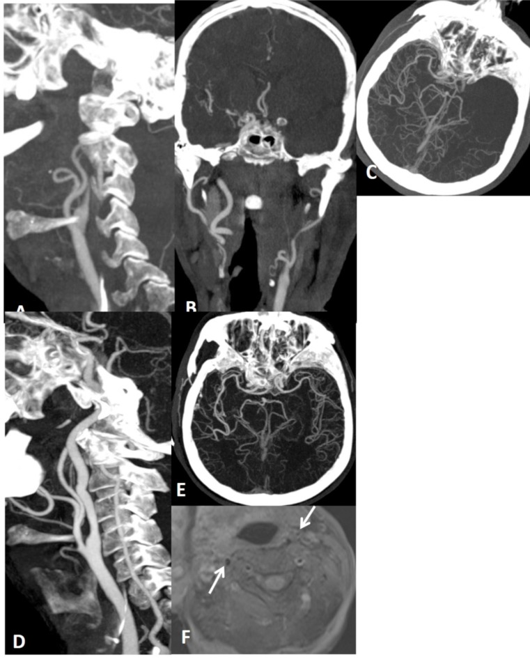 Fig. (20)