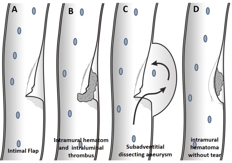 Fig. (1)