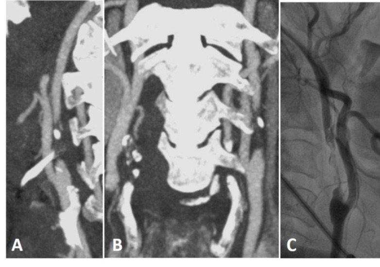 Fig. (21)