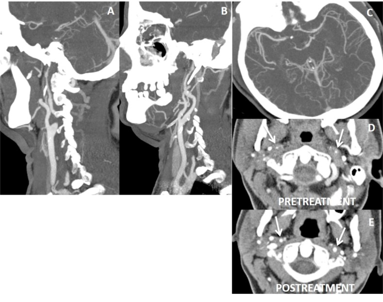 Fig. (17)