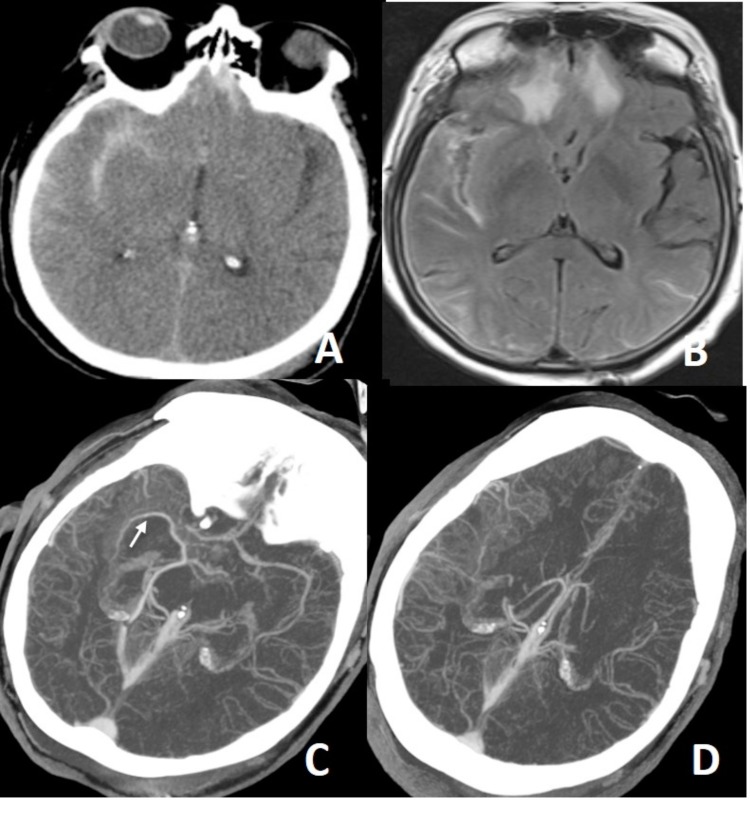 Fig. (10)