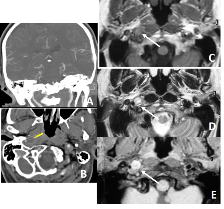 Fig. (3)