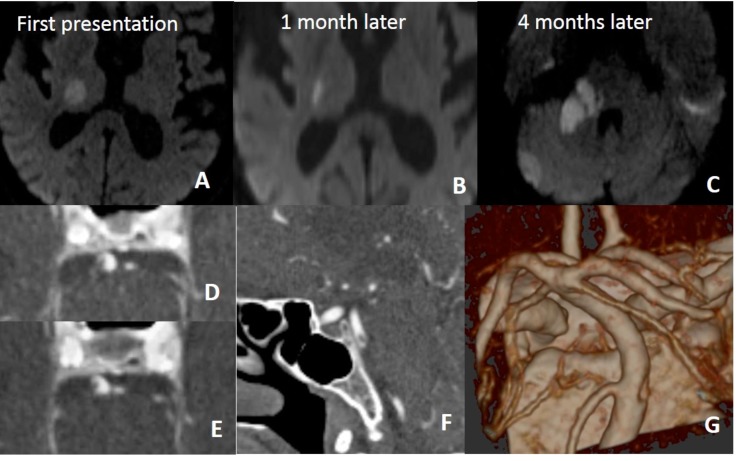 Fig. (15)