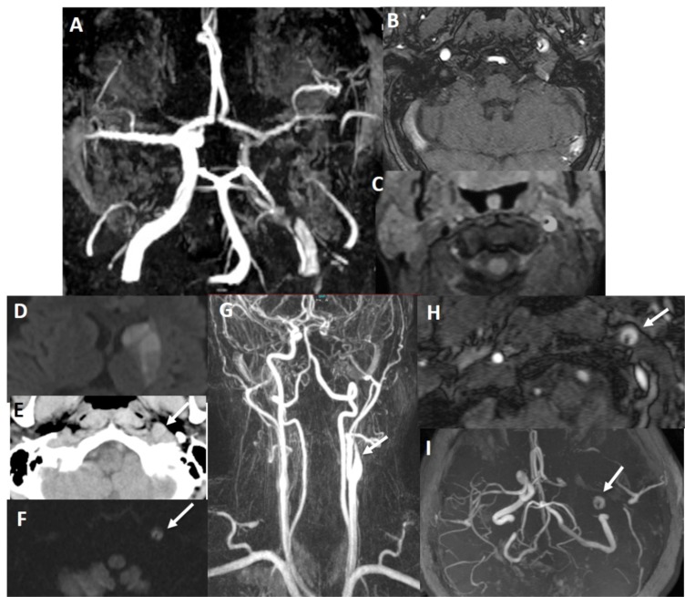 Fig. (2)