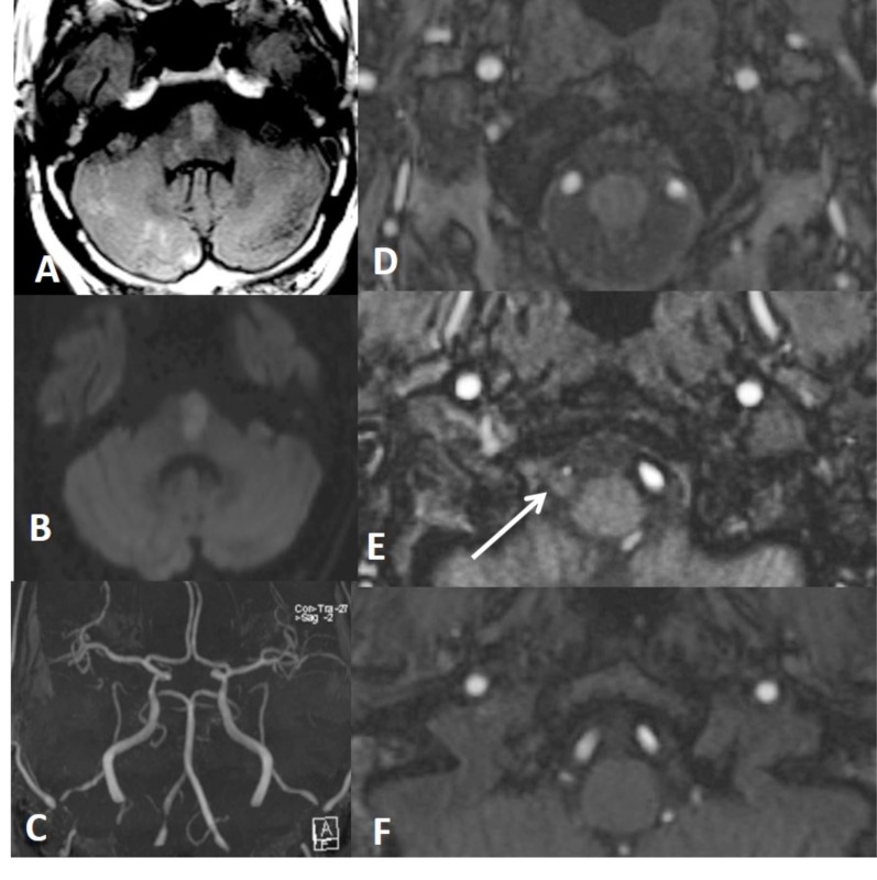 Fig. (12)