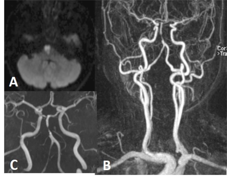 Fig. (11)