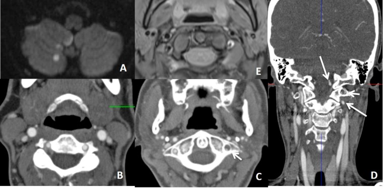 Fig. (14)