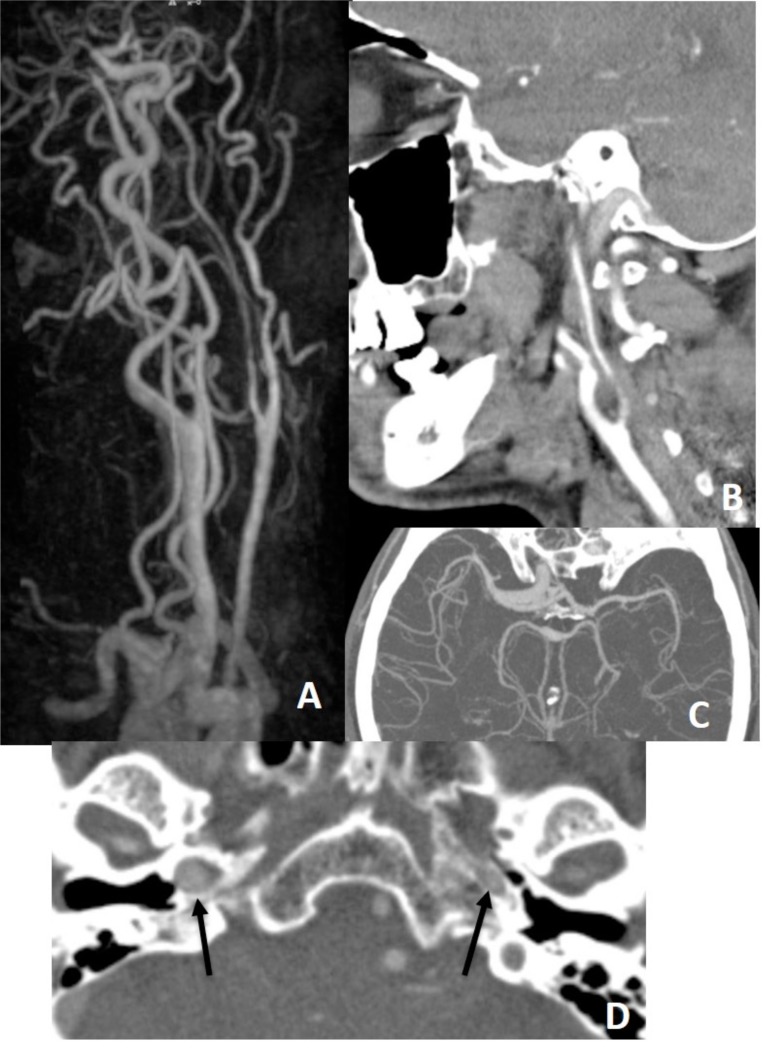 Fig. (18)