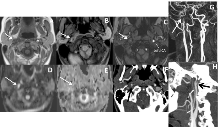 Fig. (9)