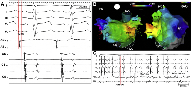 Figure 2