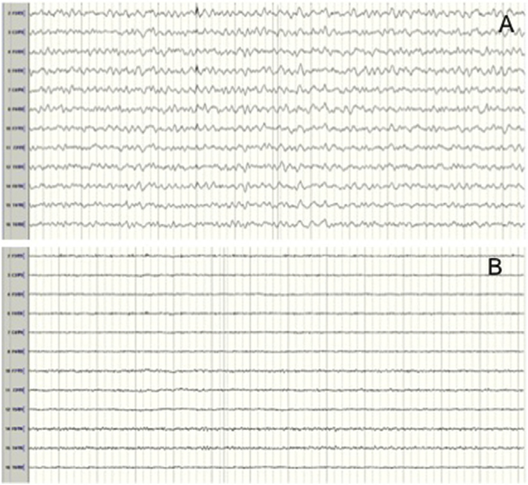 Fig 3