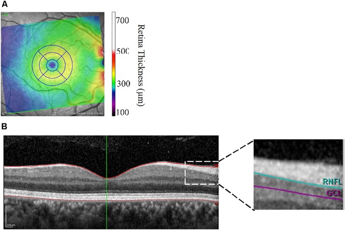 FIGURE 1