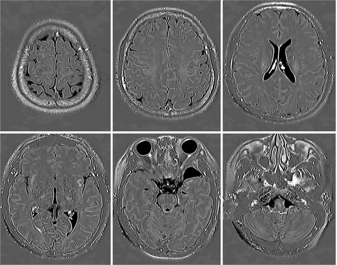 Fig. 3.