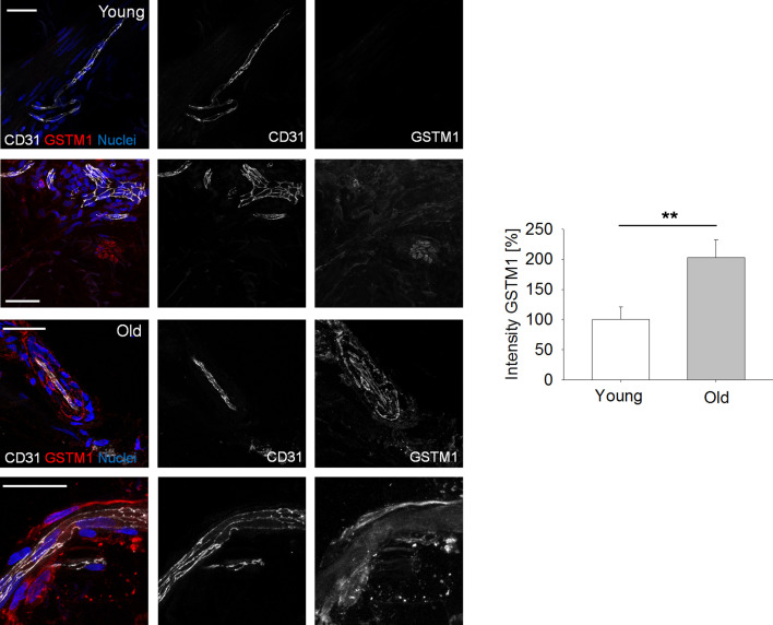 Figure 2—figure supplement 3.