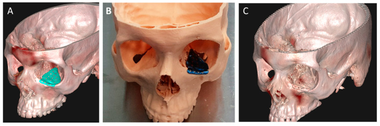 Figure 6