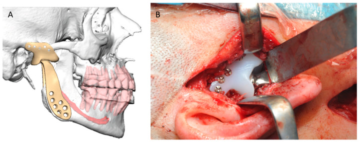 Figure 10