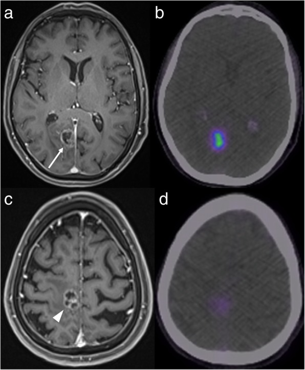 Fig. 11