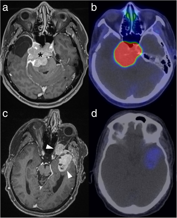 Fig. 12