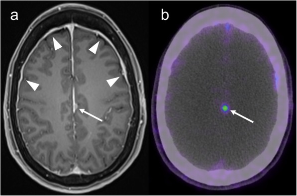 Fig. 14