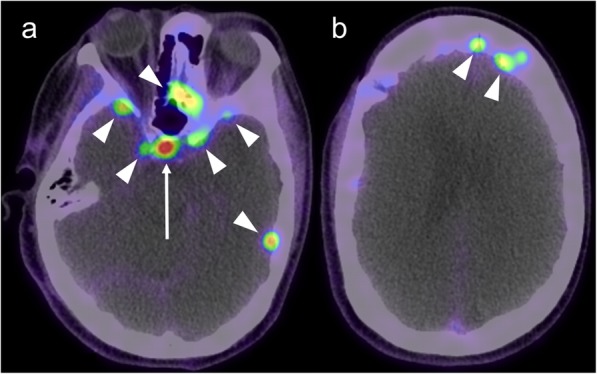 Fig. 13