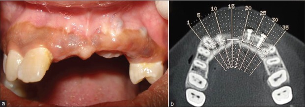 Figure 11