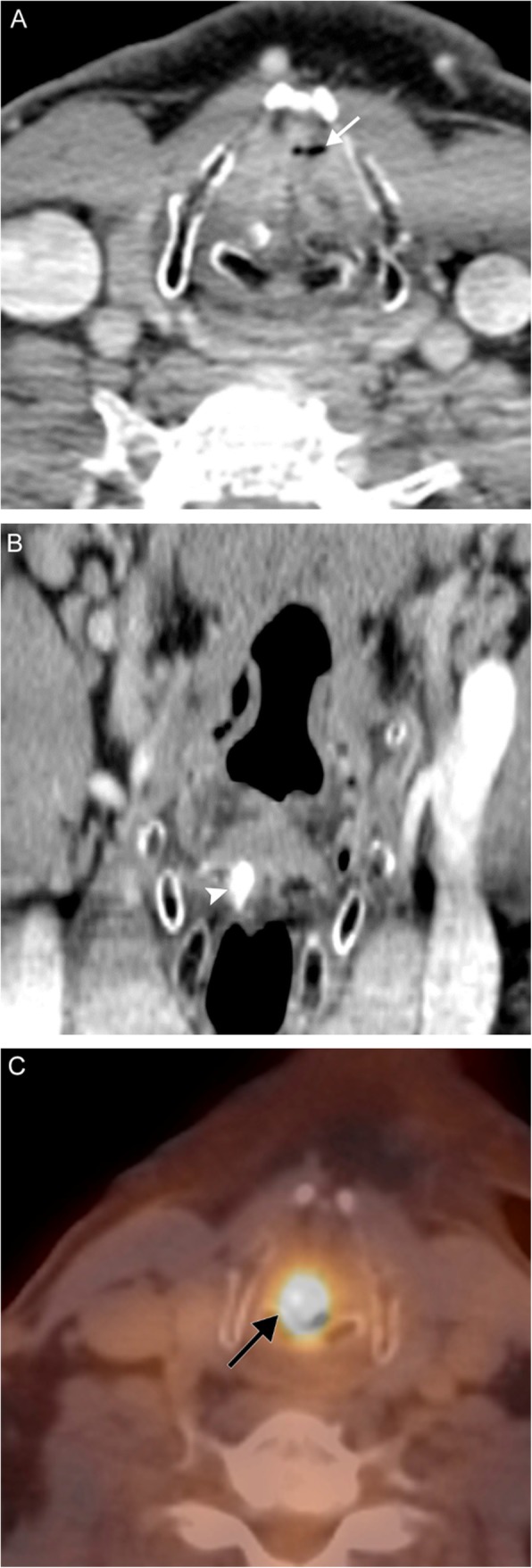 Fig. 6