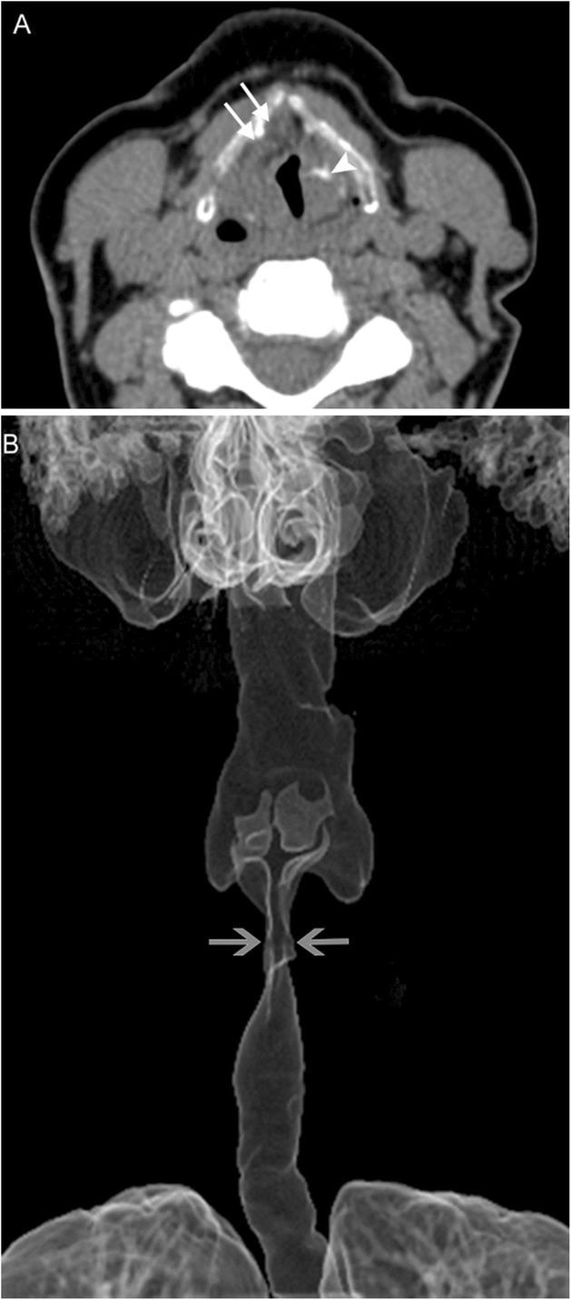 Fig. 9