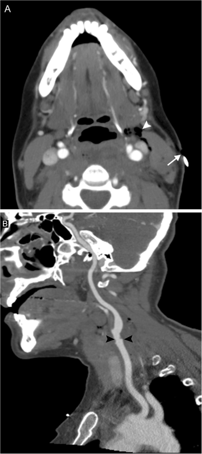 Fig. 24