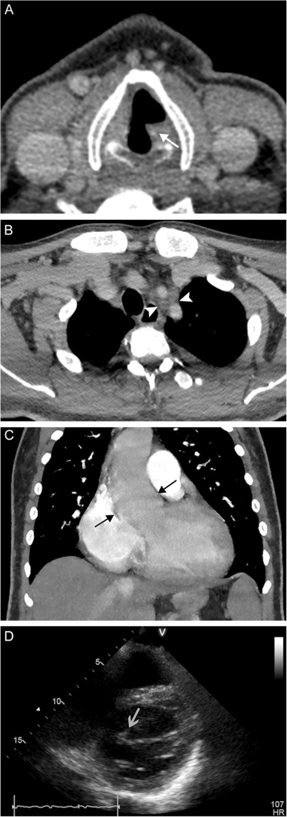 Fig. 21
