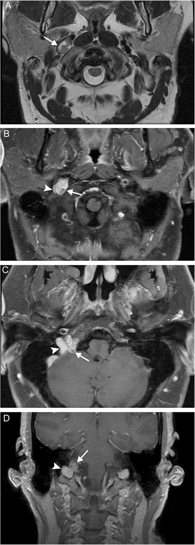 Fig. 17