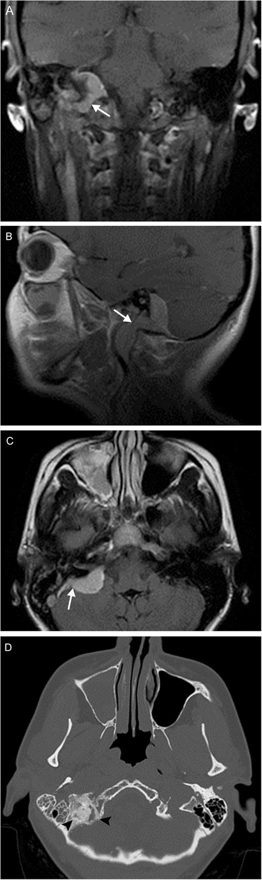 Fig. 15