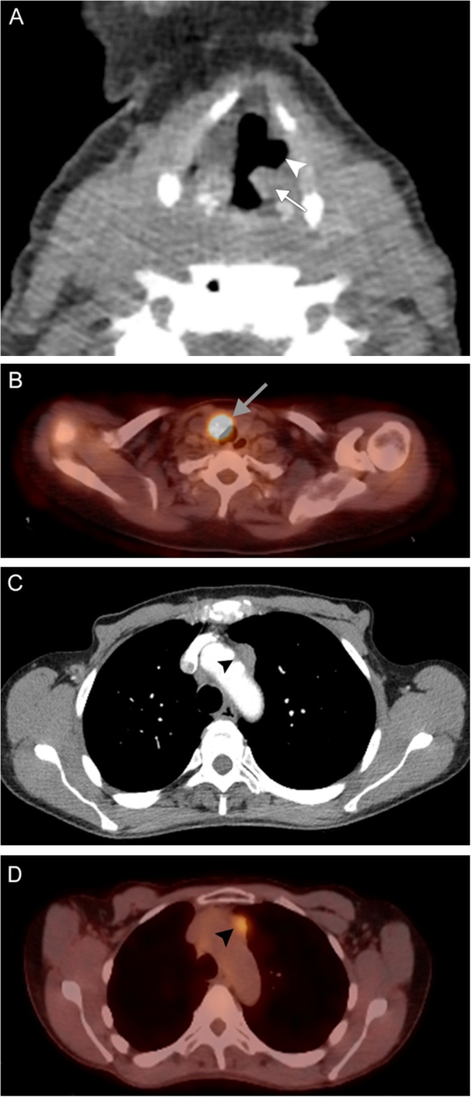 Fig. 20