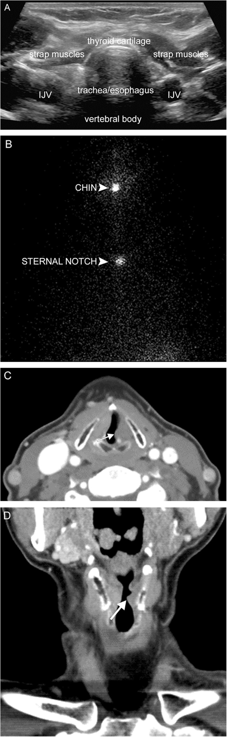 Fig. 23