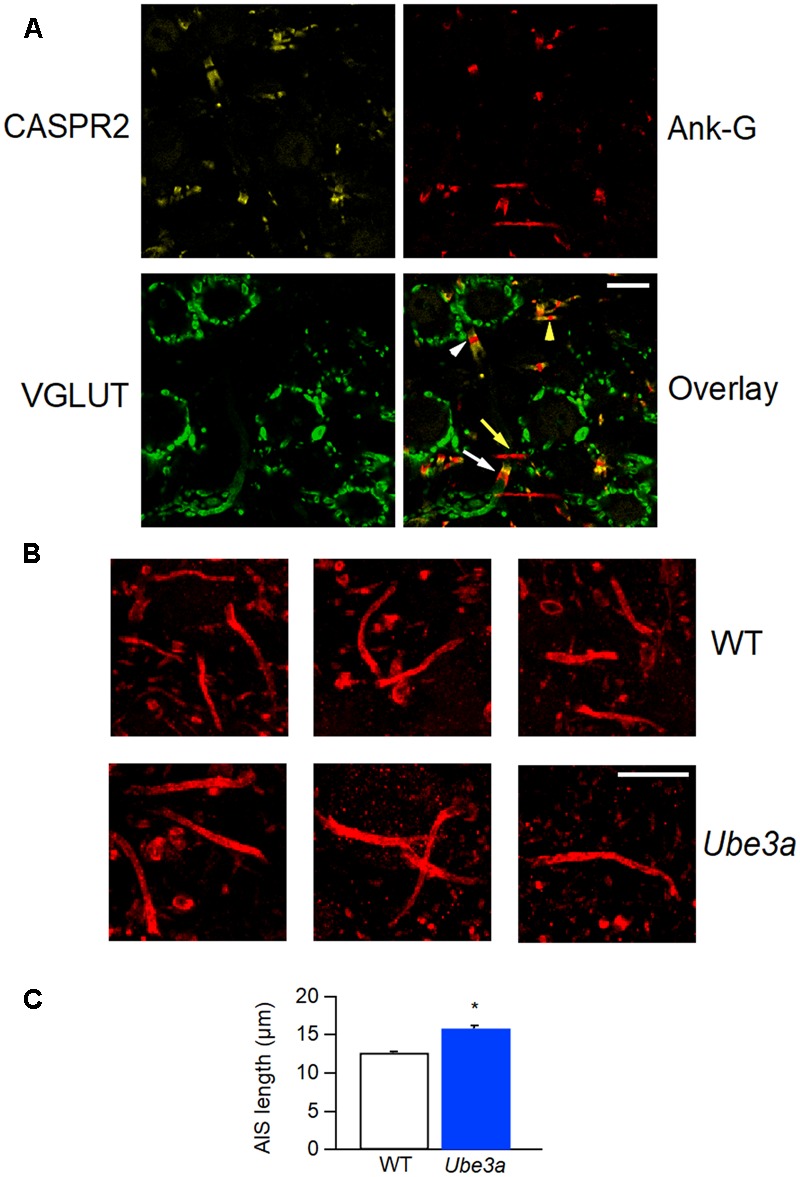 FIGURE 11