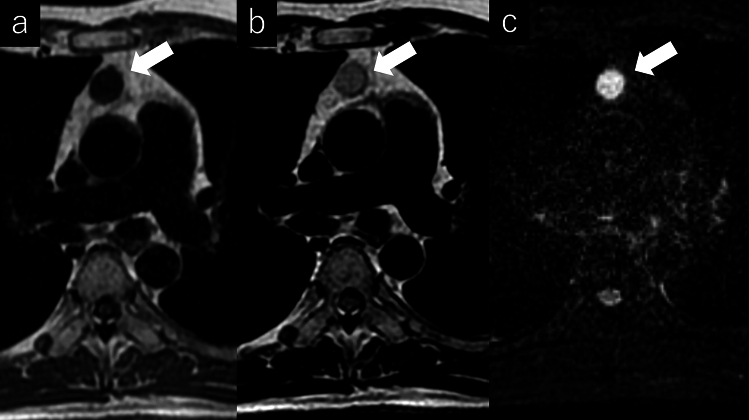 Review of clinical and diagnostic imaging of the thymus: from age ...