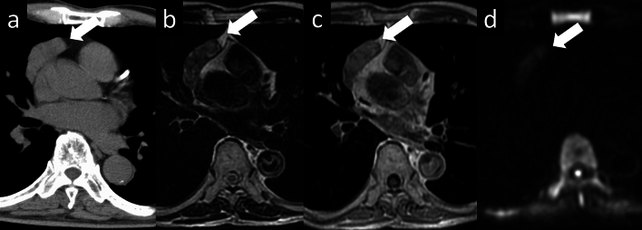 Review of clinical and diagnostic imaging of the thymus: from age ...