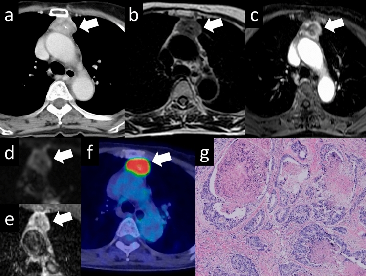 Review of clinical and diagnostic imaging of the thymus: from age ...