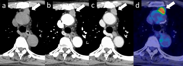 Review of clinical and diagnostic imaging of the thymus: from age ...