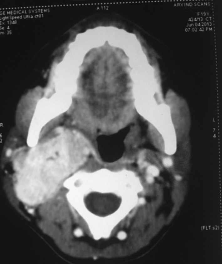 Fig. 3