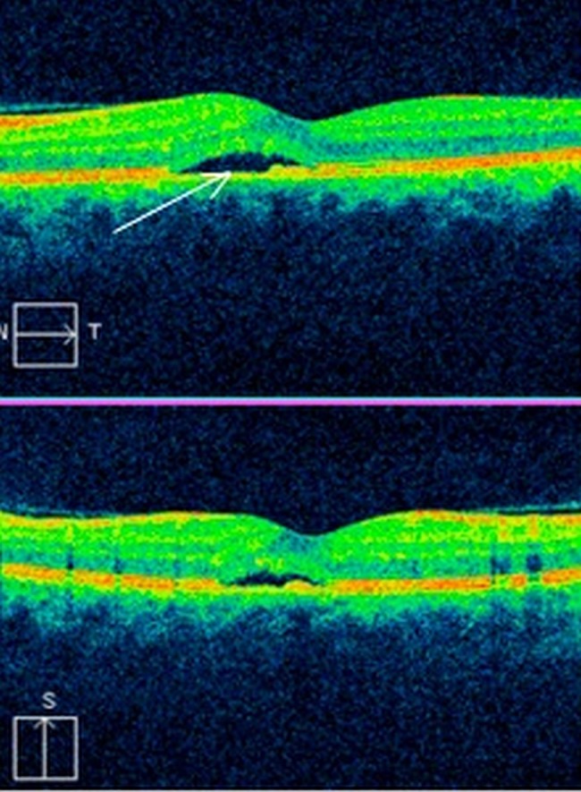 Figure 3