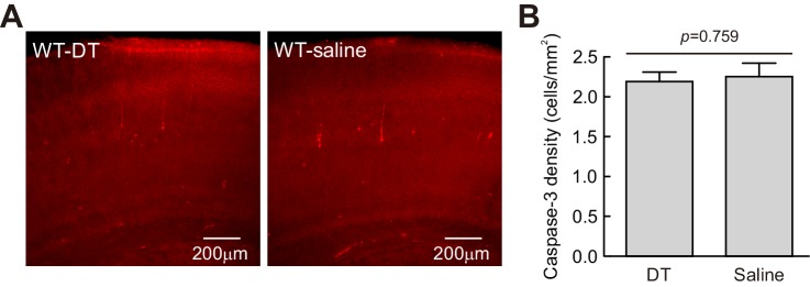 Figure 6—figure supplement 1.