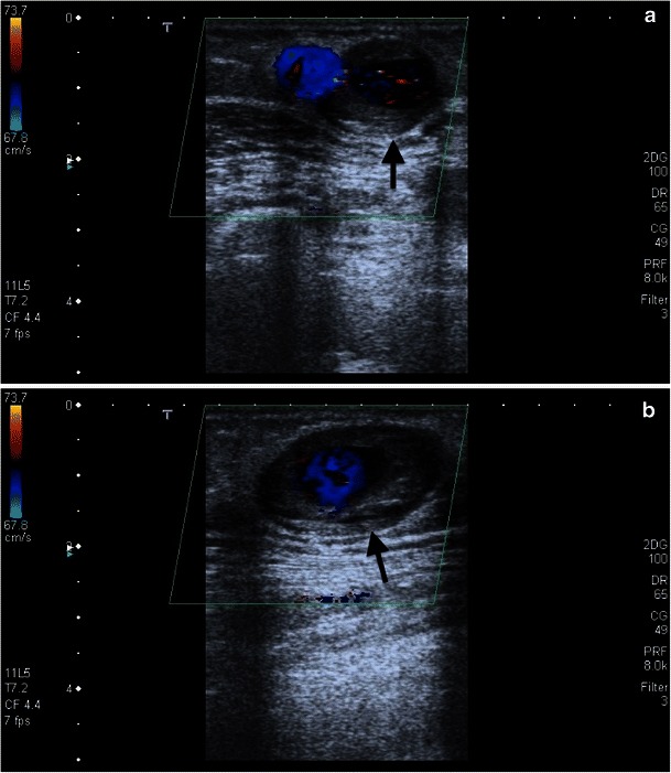 Fig. 23