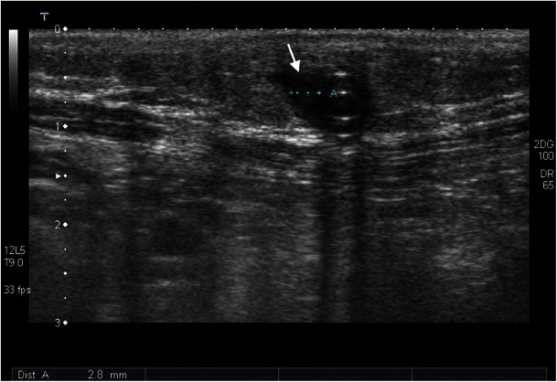 Fig. 14