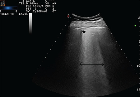 Figure 20