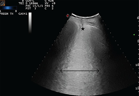 Figure 21