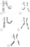 114