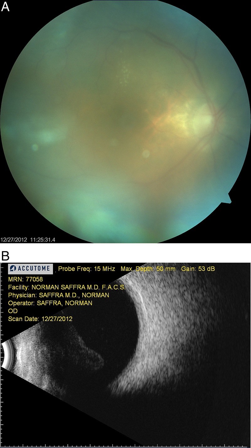 Figure 1