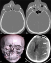 Figure 14