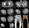 Figure 16