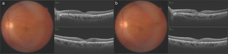 Fig. 2
